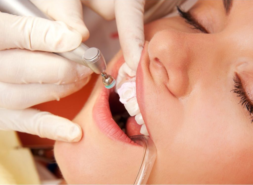 limpieza dental